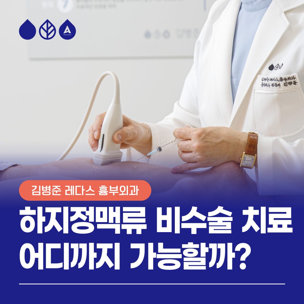 하지정맥류 비수술 치료