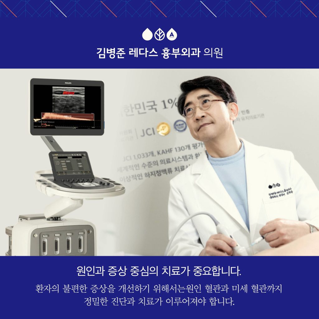 하지정맥류 비수술치료로 해결