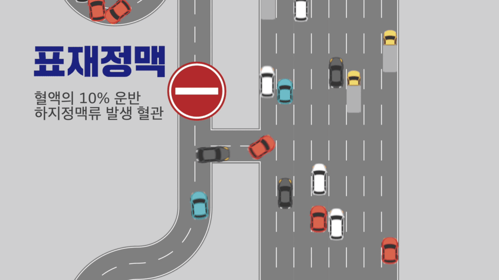 부산 하지정맥류 표재정맥