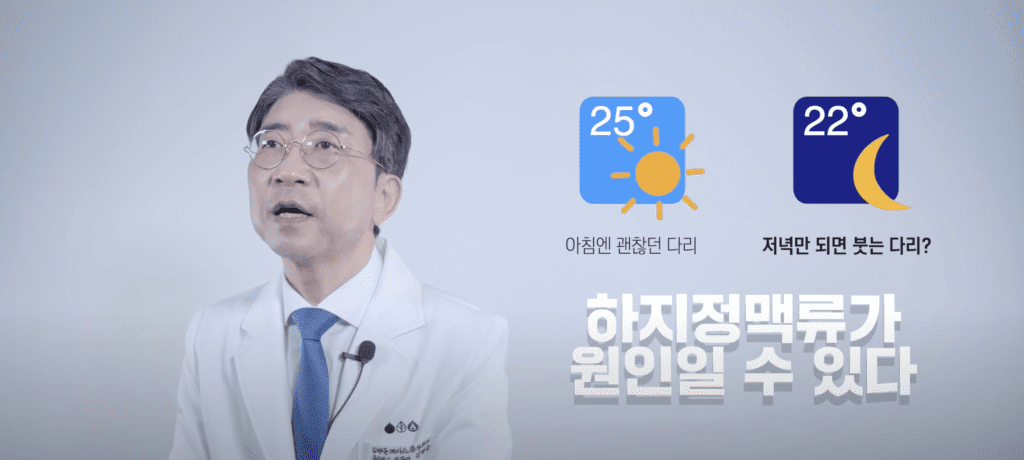 저녁만 되면 붓는 다리는 하지정맥류가 원인일 수 있다