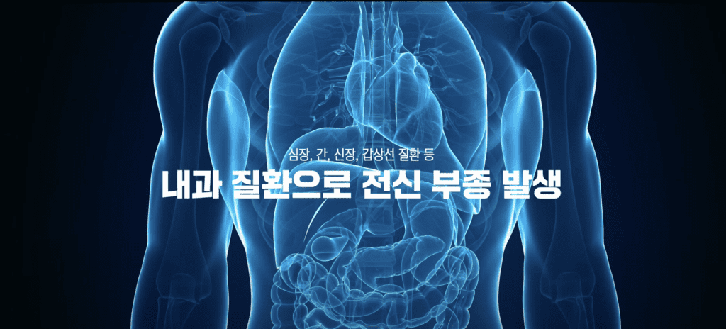 다리 부종 원인 심장, 간, 신장, 갑상선 질환 등 내과 질환으로 전신 부종 발생할 수 있음