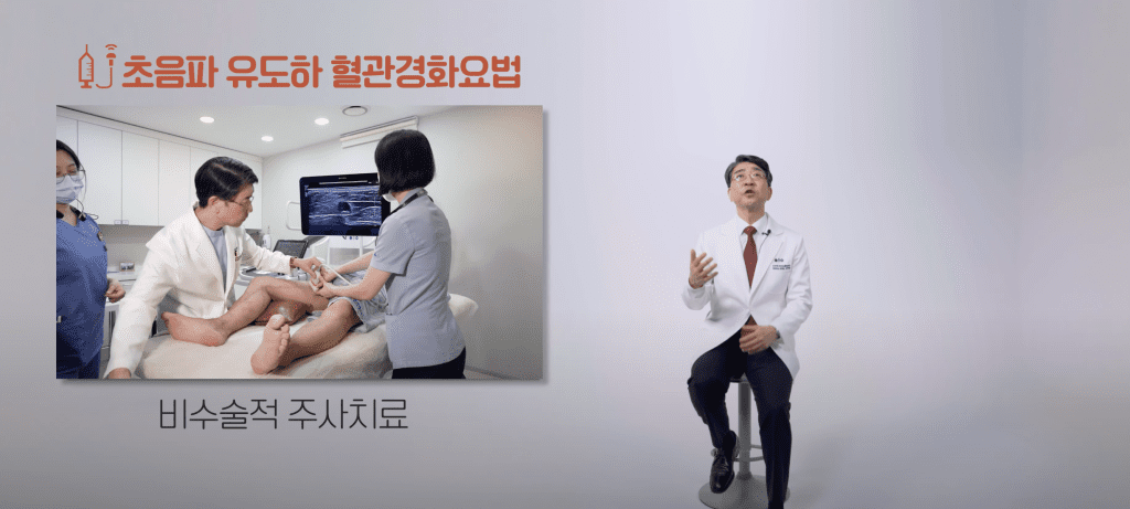 하지정맥류 당일치료 가능한 초음파 유도하 혈관경화요법