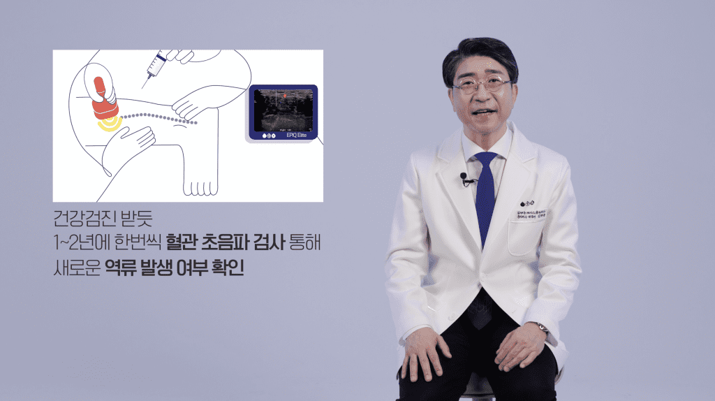 하지정맥류 장긴검진 하는 이유