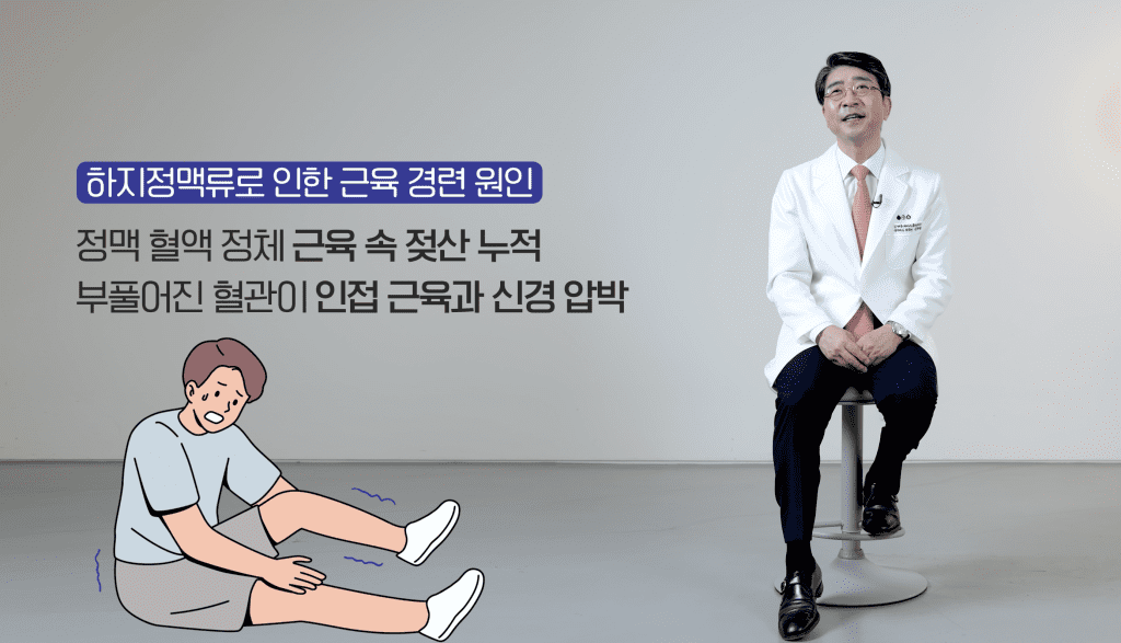 하지정맥류로 인한 근육 경련 원인