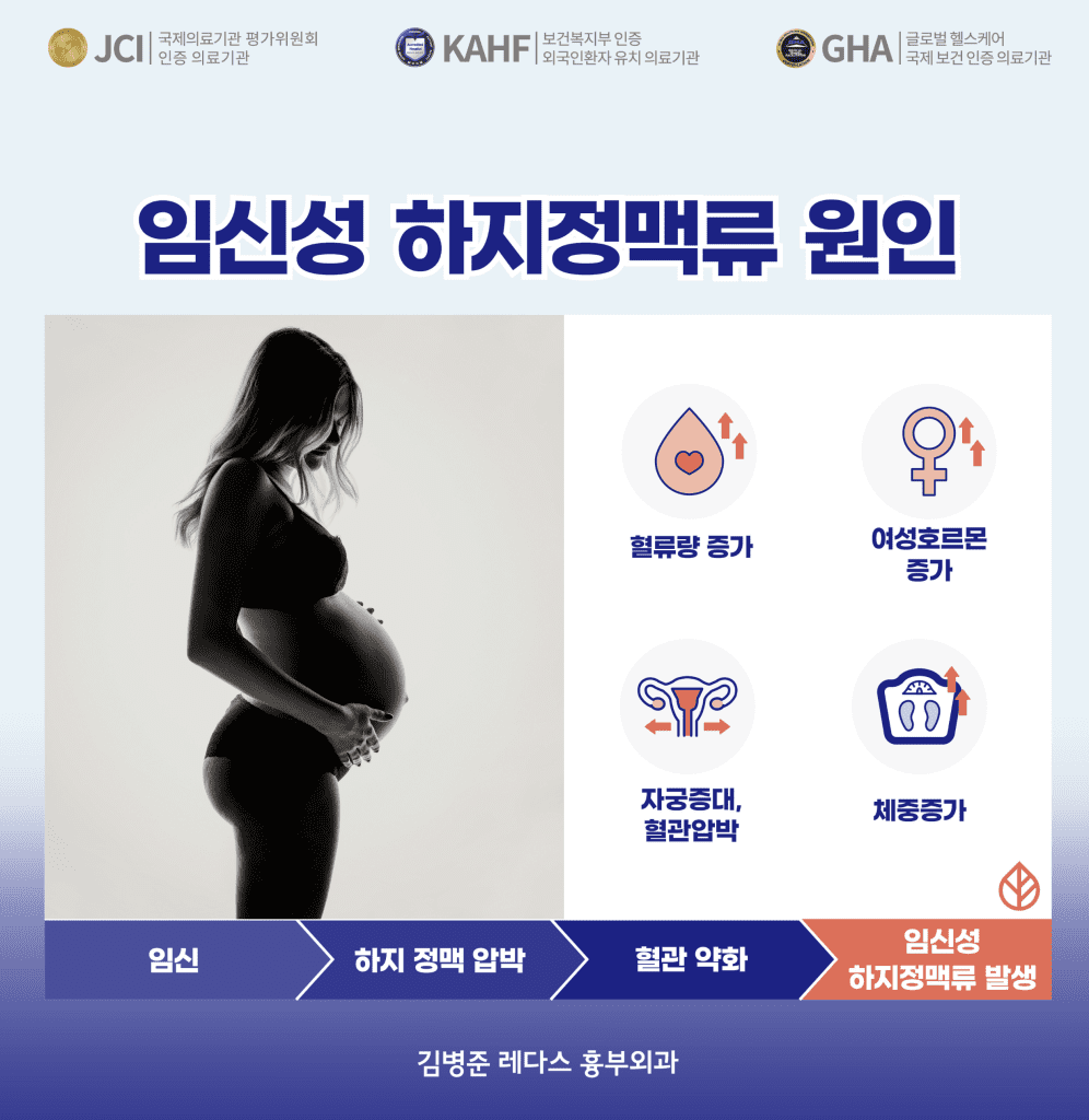 임신 하지정맥류 원인