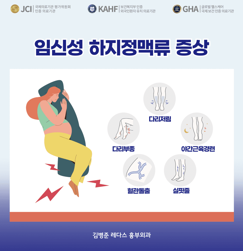 임신 하지정맥류 증상
