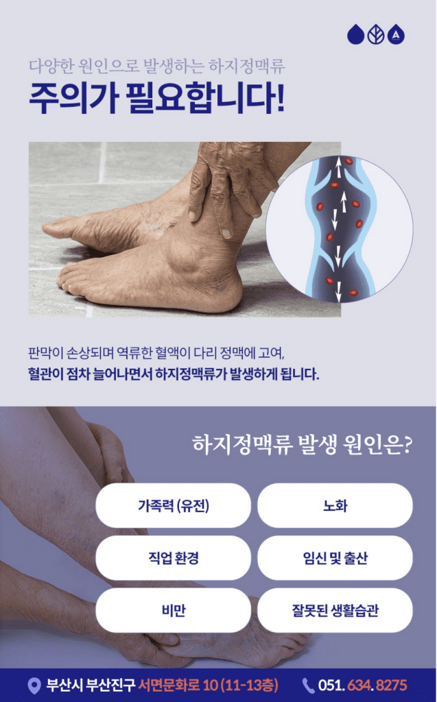 부산혈관초음파검사 하지정맥류라고 하면 혈관이 튀어나오는 증상이라고 생각하지만 혈관 돌출이 나타나는 경우가 절반 이하라는 설문 결과도 있습니다. 