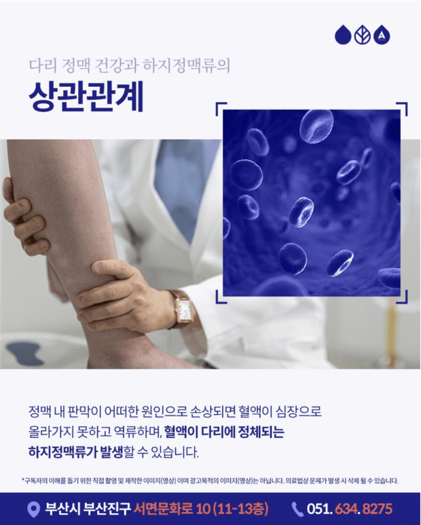 하지정맥류흉부외과 다리가 아프면 정형외과나 통증의학과, 신경과, 한의원을 먼저 떠올리는 경우가 많은데요. 그러나 하지정맥류로 의한 증상이라면, 진단과 치료를 받는 것이 더 적합할 수 있습니다. 흉부와 하지, 언뜻 연관성이 없어 보일 수 있는데요. 