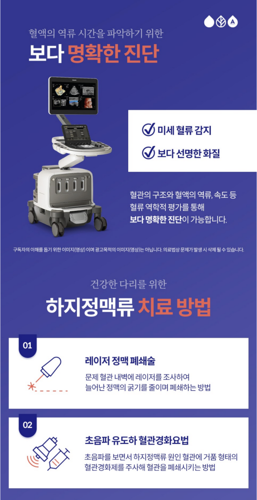 하지정맥다리실핏줄 이전에는 심하지 않았던 다리실핏줄 이 점점 퍼져나간다면, 또 푸른 혈관이 도드라져 보이거나 울퉁불퉁 튀어나온다면 하지정맥류를 의심해보셔야 합니다.