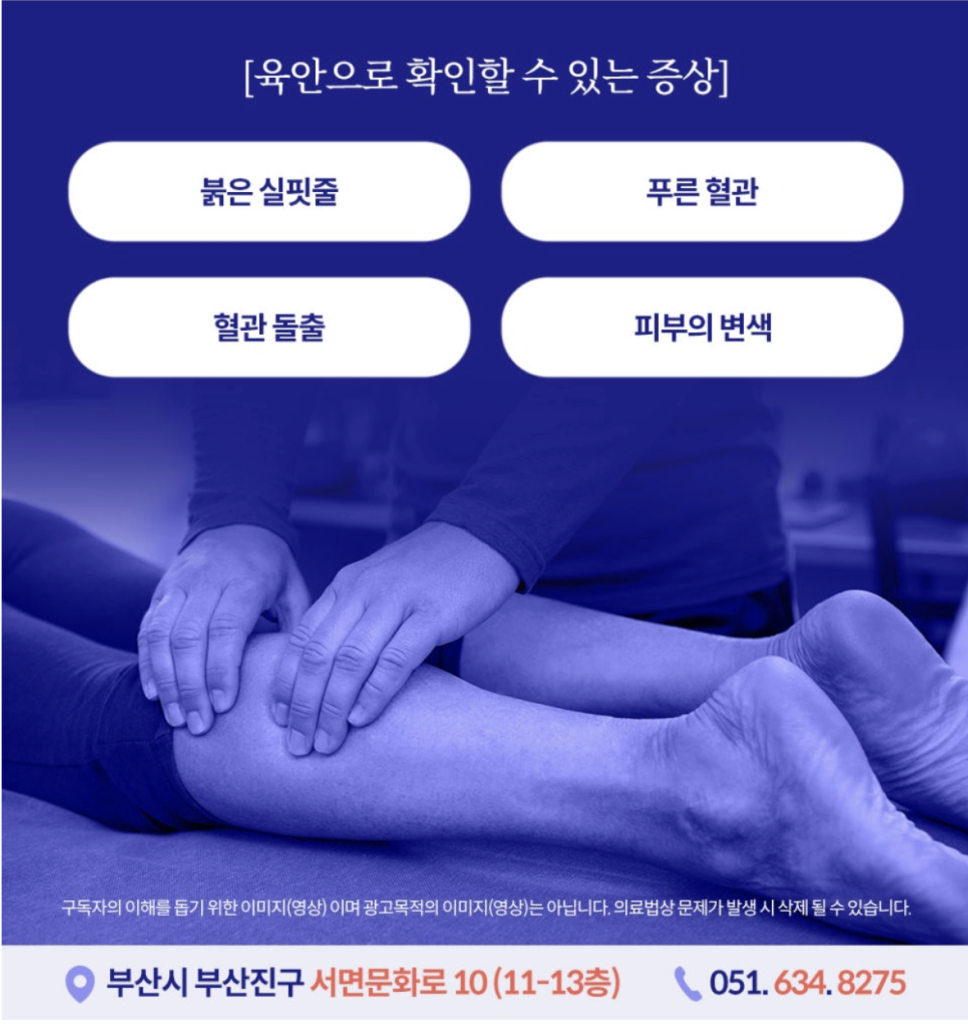 다리가 무거운 원인 다리가 자주 무겁고 불편한 느낌이 든다면 피로 탓으로 생각할 때가 많습니다. 