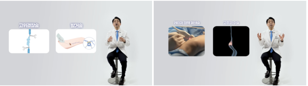 하지정맥류 재발 원인 논문 하지정맥류는 치료 후에도 생물학적 원인에 의해 재발할 수 있다는 것입니다. 오늘은 해외 연구 논문을 통해 하지정맥류 재발과 그 원인에 대해 설명드리겠습니다. 