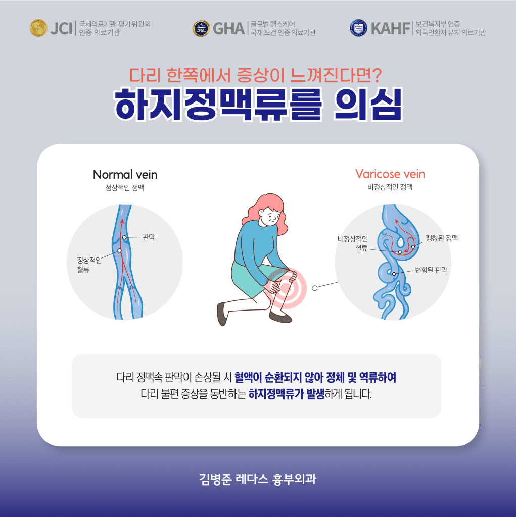 왼쪽다리통증 다리 한쪽에서 증상이 느껴진다면? 하지정맥류를 의심