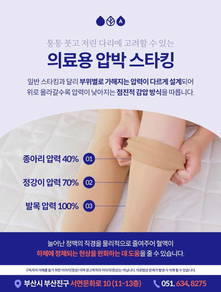 부위별로 압력이 다르게 설계된 의료용 압박스타킹의 원리 그래픽