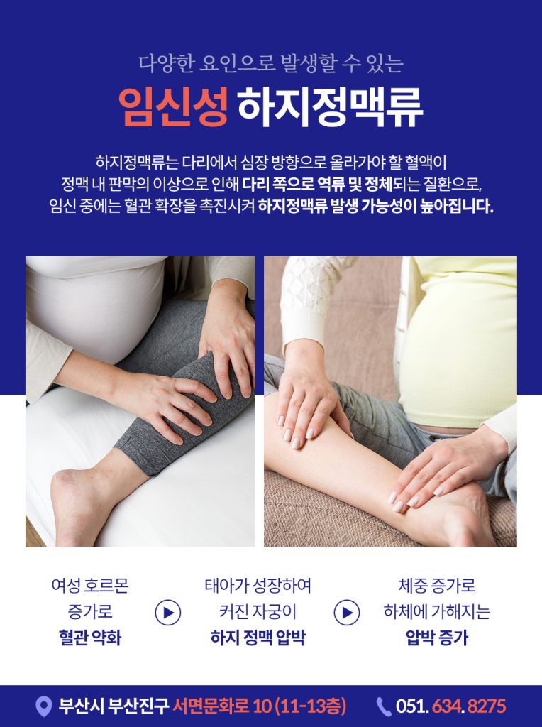 
임산부하지정맥류 이렇게 관리하셔야 합니다
임산부하지정맥류 임신 중에는 다양한 신체 변화를 겪게 되는데요. 그중 하나가 바로 '하지정맥류'입니다. 단순히 다리가 좀 붓는 정도로 생각할 수 있지만, 임신 중에 발생한 하지정맥류는 출산 후에도 건강과 삶에 영향을 줄 수 있는 질환입니다.
