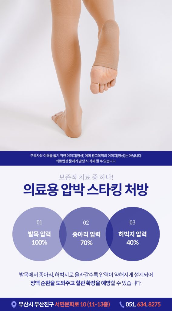
임산부하지정맥류 이렇게 관리하셔야 합니다
임산부하지정맥류 임신 중에는 다양한 신체 변화를 겪게 되는데요. 그중 하나가 바로 '하지정맥류'입니다. 단순히 다리가 좀 붓는 정도로 생각할 수 있지만, 임신 중에 발생한 하지정맥류는 출산 후에도 건강과 삶에 영향을 줄 수 있는 질환입니다.