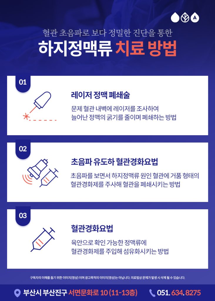 하지정맥류 증상에 따른 치료법