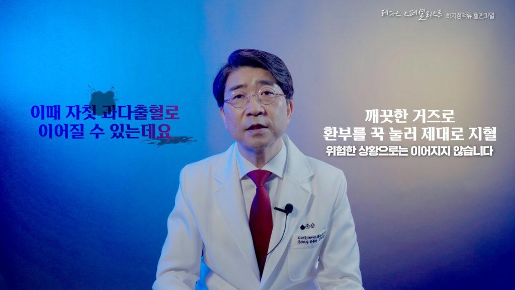 하지정맥류 혈관 과다출혈
