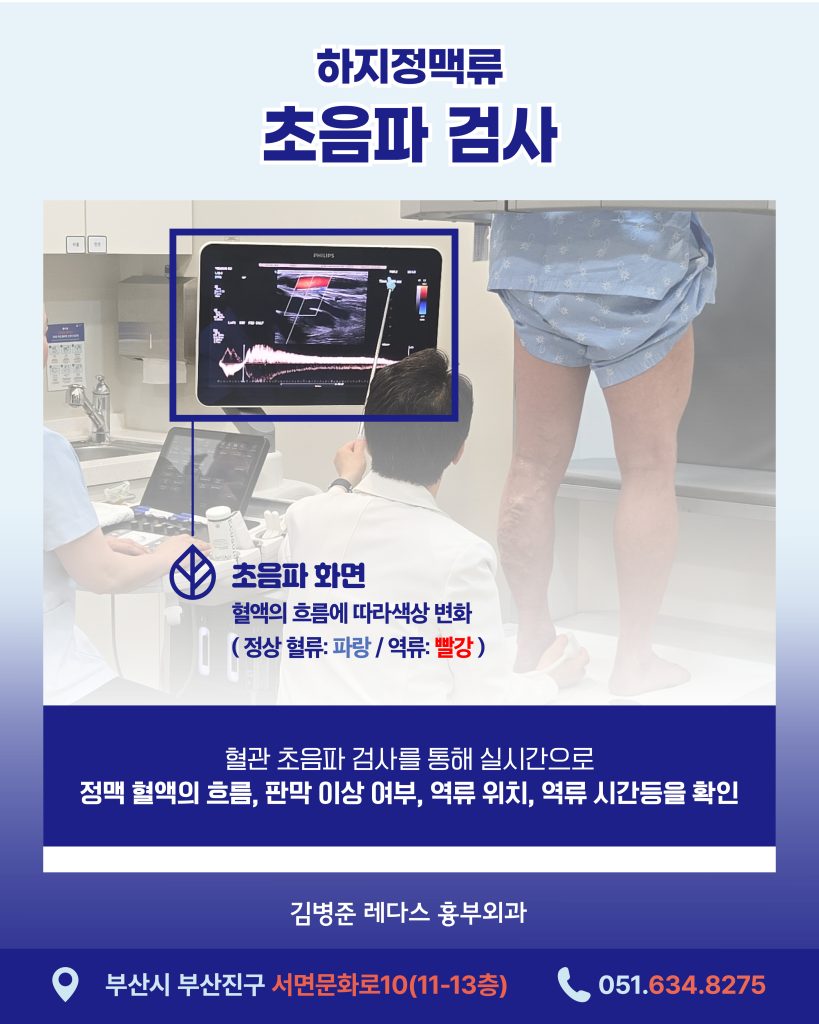 다리 실핏줄 초음파 검사